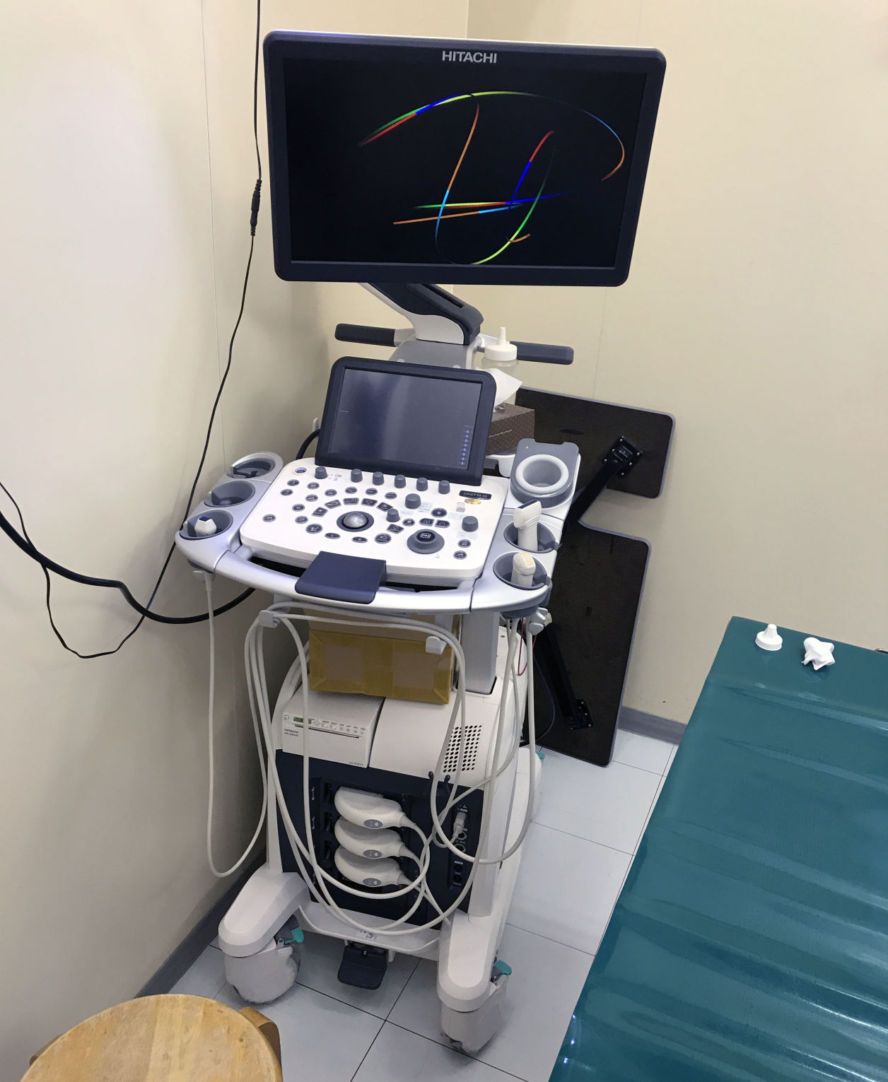 超音波スキャナー